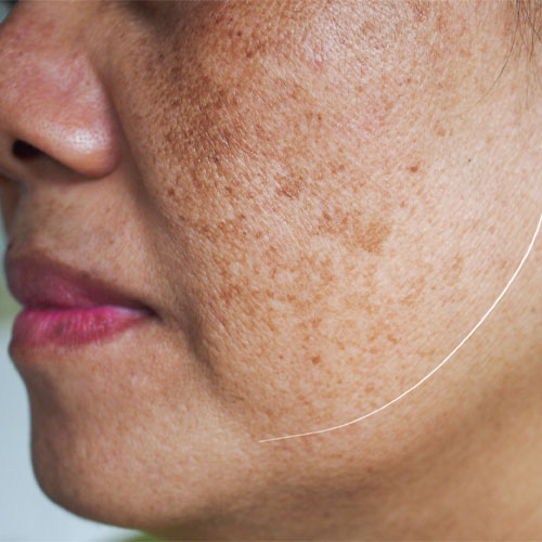 skin-2a